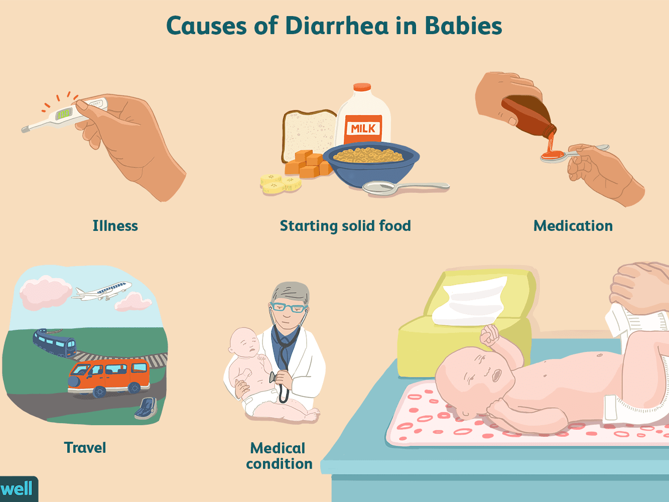 Bayi Cirit-Birit, Muntah-Muntah & Demam, Hati-Hati Dengan ...