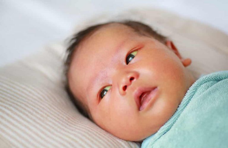 6 Cara mencegah Bayi Kuning Selepas Lahir, Ketika Mengandung Kena Amalkan